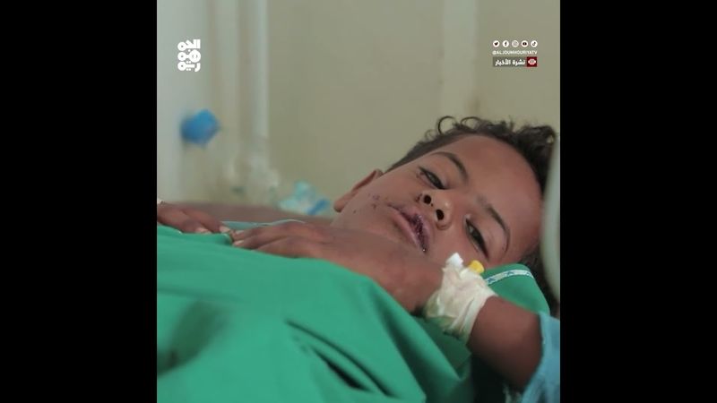 الصليب الأحمر: ألغام الحوثيين تهدد اليمنيين وتعوق جهود الإغاثة