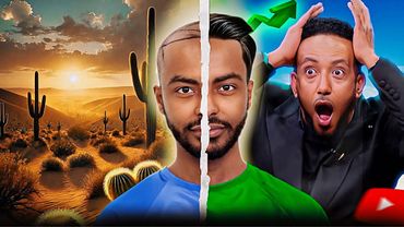 ከመላጣ ወደ ራስታ | My Hair Transplant Journey – Before & After