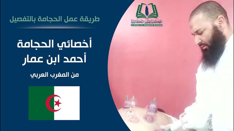 طريقة عمل الحجامة بالتفصيل | أخصائي الحجامة أحمد بن عمار