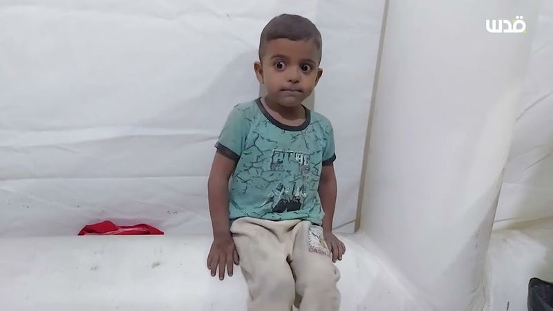 قصف إسرائيلي يستهدف منزلاً وإصابات بصفوف المدنيين برفح