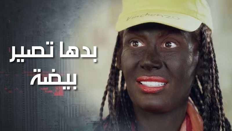 اتنكرت على انها بنت لونها اسود وراحت عند دكتورة التجميل لتغيرلها لونها وانصدمت بطلبها 🤣 كذب ابيض