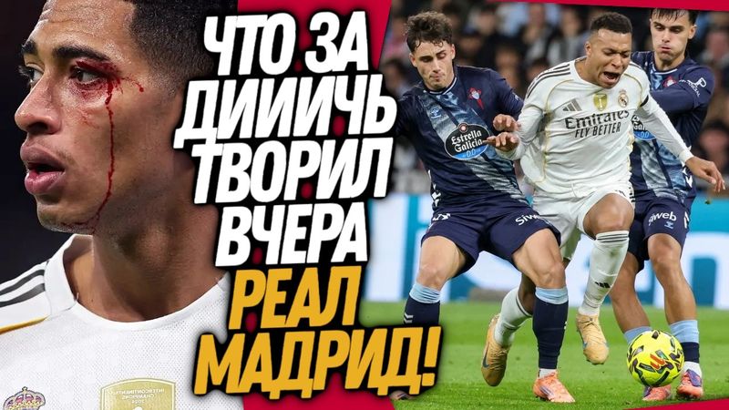 БУМ! УВОЛЬНЕНИЕ АЛОНСО ИЗ РЕАЛА! ДРАКА В МАТЧЕ КРАСНОДАР - ЦСКА / Доза Футбола