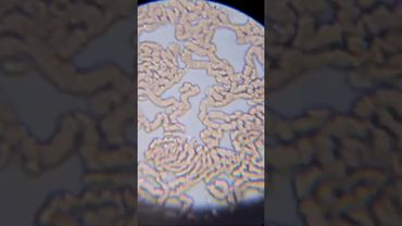 кровь после стакана горячей воды под микроскопом