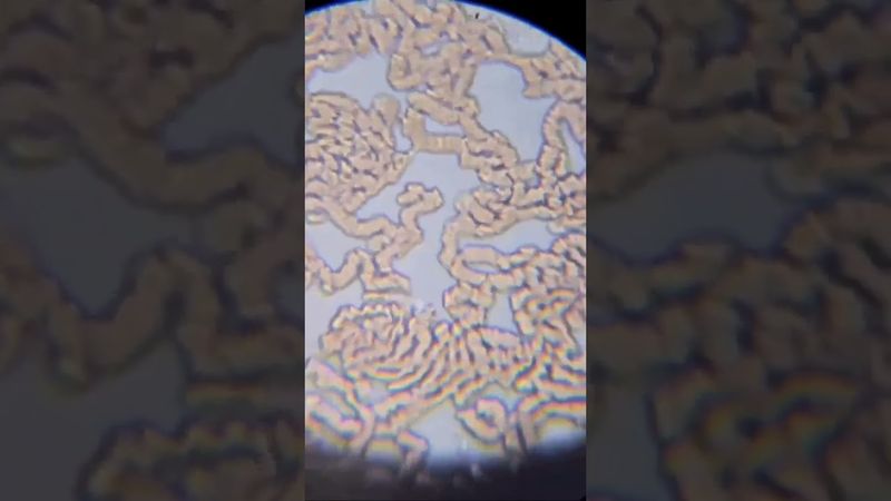 кровь после стакана горячей воды под микроскопом