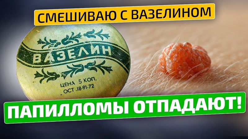 Папилломы, бородавки и другие образования на коже боятся этого средства!