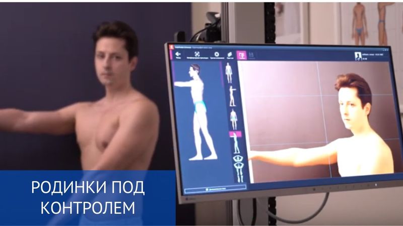 Родинки под контролем