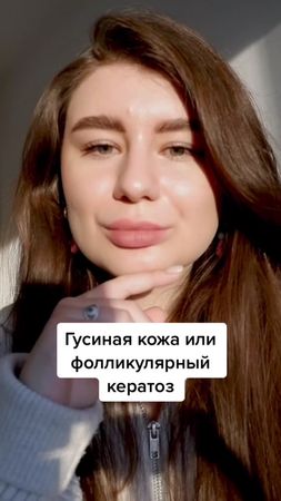 #акне #прыщи #дерматолог #гусинаякожа #косметолог