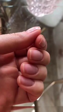 #здоровыеногти #здоровье #здоровьеженщины #дефицитжелеза