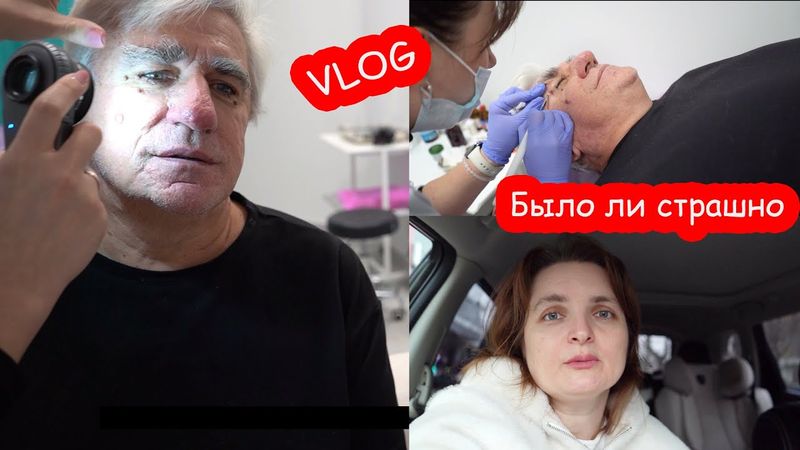 VLOG Удаляем родинки. Я не знала как это делается