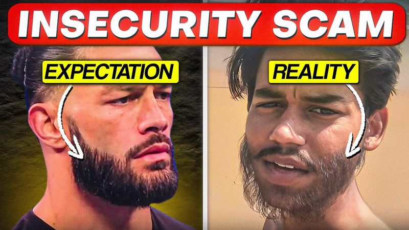 Beard Transplant Destroyed His Life 🥺- Mogcast Episode 1