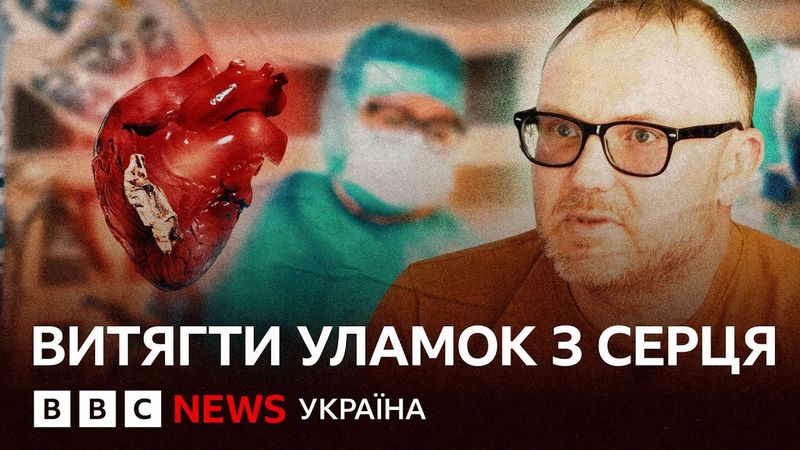 Витягти уламок з серця: як українці розробили прилад, що рятує життя