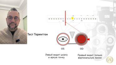 Полезное от КМК. Показатель АК/А. Коротко - что, как, зачем)