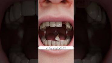 اگه دندونت رو قورت بدی چی‌ میشه؟🦷😨