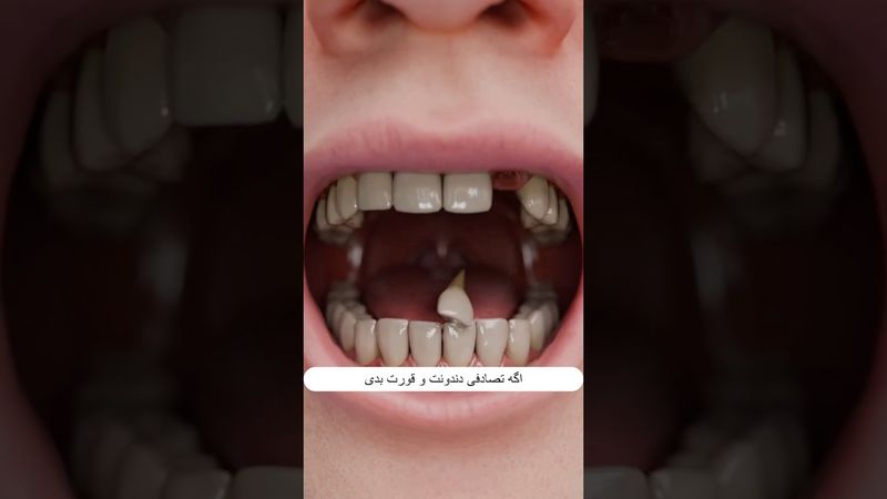 اگه دندونت رو قورت بدی چی‌ میشه؟🦷😨