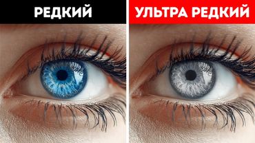 ПОДКАСТ: Почему вы, вероятно, никогда не встречали человека с серыми глазами