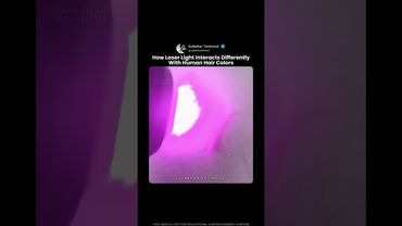 Why Dark Hair Burns Faster Under Laser Light! ⚡😳