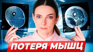 №1 ПРИЧИНА СТАРЕНИЯ: как остановить САРКОПЕНИЮ? Потеря мышц и здоровье