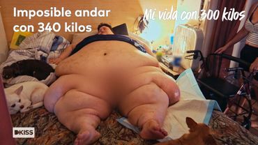 Margaret pesa 340 kilos y no puede levantarse de la cama | Mi vida con 300 kilos