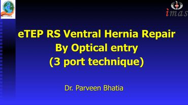 eTEP RS Ventral Hernia Repair by Optical entry & 3 Port | Step by step narration | Dr.Parveen Bhatia