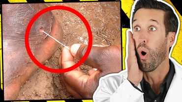 ER Doctor REACTS to Deadliest Parasites Found Inside Humans