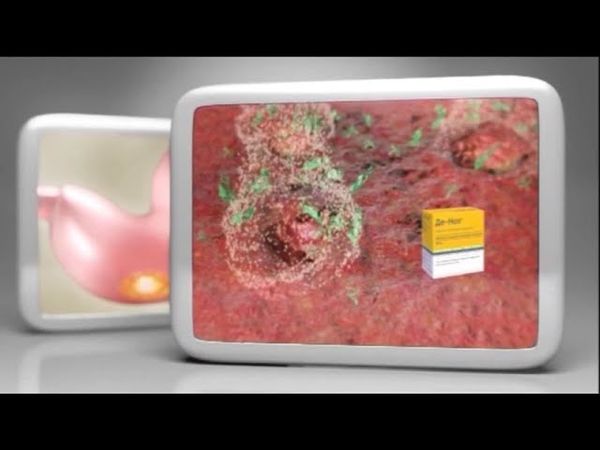 (2015) Де-Нол - Настоящая защита от язвы и гастрита