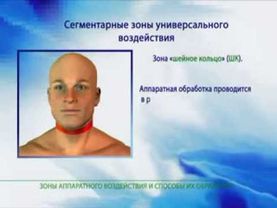 Зоны воздействия и их обработка   1 часть