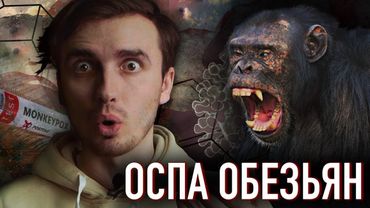 ОСПА ОБЕЗЬЯН: Новая пандемия уже на пороге - [История Медицины]