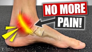 Fix Inner Ankle And Arch Pain! [Tibialis Posterior Tendonitis Exercises]