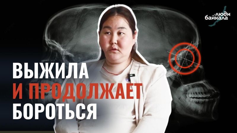 ВЫЖИТЬ ПОСЛЕ ВЫСТРЕЛА В ЛИЦО // СТРЕЛОК — НА СВОБОДЕ