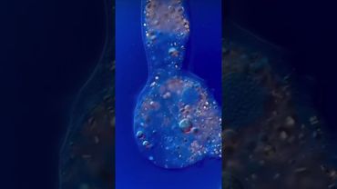 Как Движется Амёба Под Микроскопом