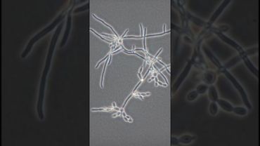 Гриб, который живёт в нас — в ускоренной съёмке