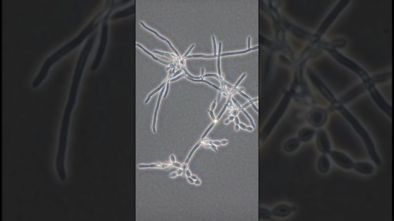 Гриб, который живёт в нас — в ускоренной съёмке