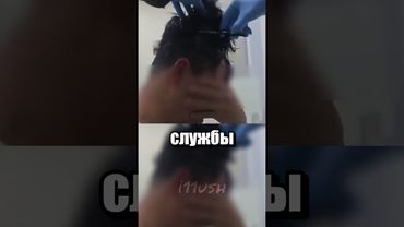 Все же это была не перхоть..