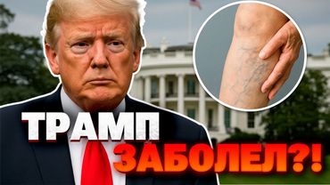 Слухи о здоровье Трампа подтвердились : что с ним случилось?