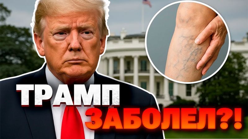 Слухи о здоровье Трампа подтвердились : что с ним случилось?