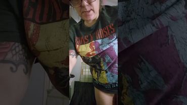 This is Scaliosis and I've lost all quality of life at the age of 50. (2025)