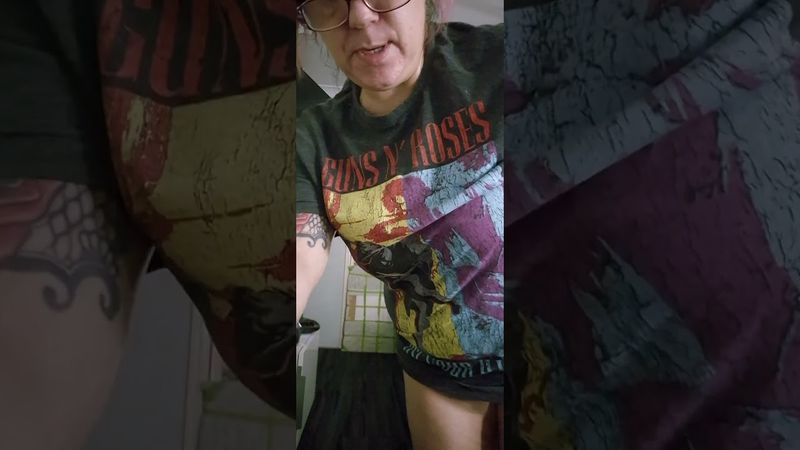 This is Scaliosis and I've lost all quality of life at the age of 50. (2025)