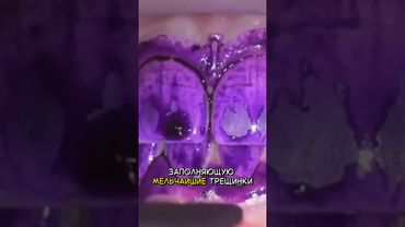 🦾 Регенерация зубной эмали #наука #qwerty #новостинауки