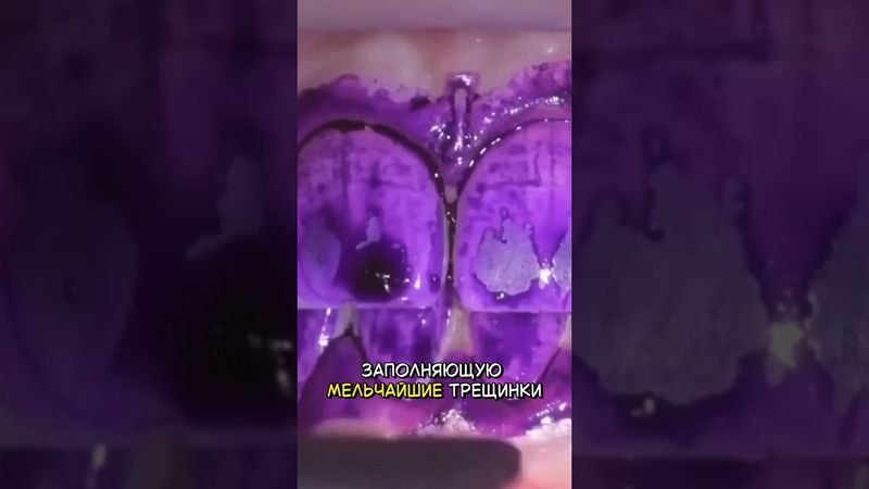 🦾 Регенерация зубной эмали #наука #qwerty #новостинауки