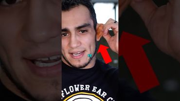 Por qué Los Peleadores Quieren Orejas de COLIFLOR?! 🥦 #ufc