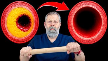 قم بذلك مرة واحدة في الأسبوع فقط! وسوف يتحسن نغمة الأوعية الدموية فورًا!