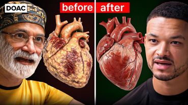 胰岛素医生：最快燃烧危险内脏脂肪的方法！我在病人体内发现霉菌！