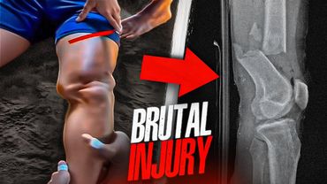 The WORST MMA Video You'll Ever Watch😳