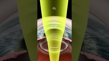 А ты умеешь расфокусировать зрение?