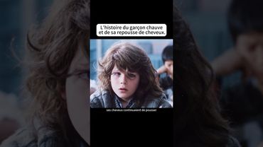 L'histoire du garçon chauveet de sa repousse de cheveux.#film #movie