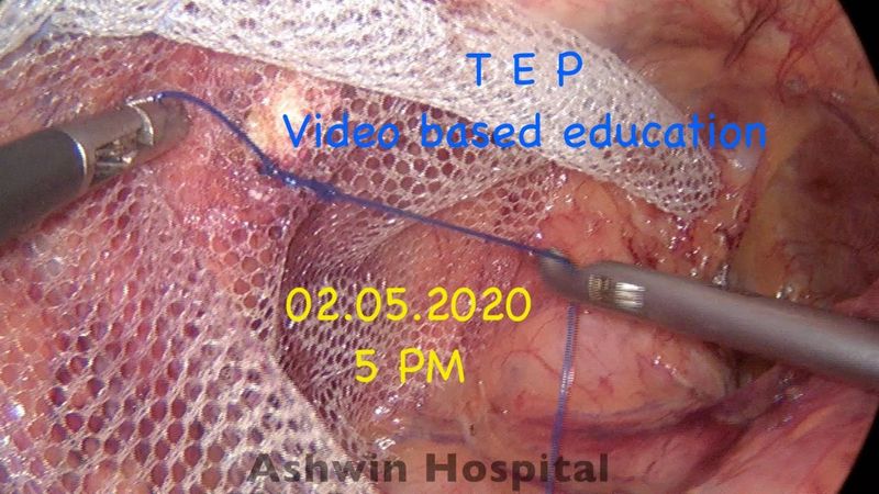 TEP - video based education