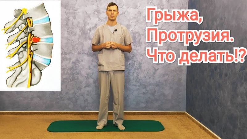 Грыжа, протрузия поясничного отдела позвоночника. Рекомендации