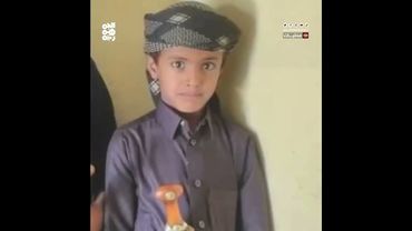 صحيفة: وفاة طفل في شبوة بعد تعرضه لعضة قط في فمه