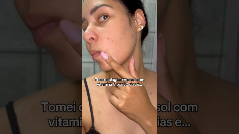 O colágeno VERISOL CERTO, pode sim fazer uma grande mudança
