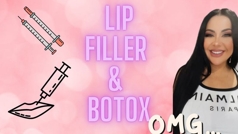 Lip Filler & Botox. Things you need to know.